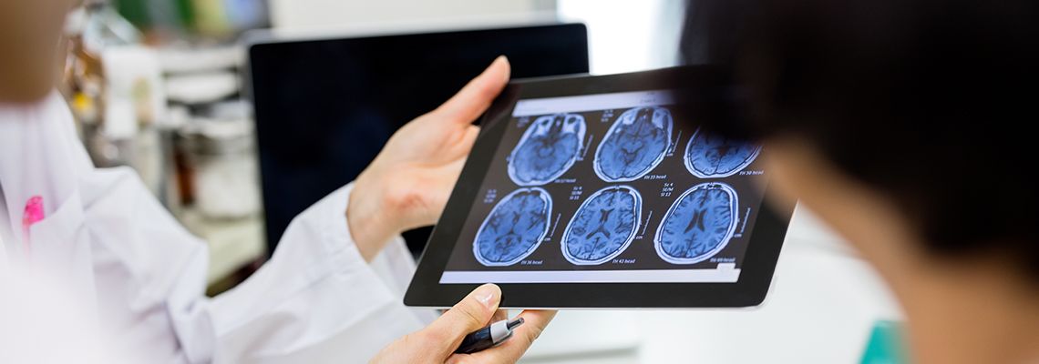 Doctor holding tablet with images of brain scan