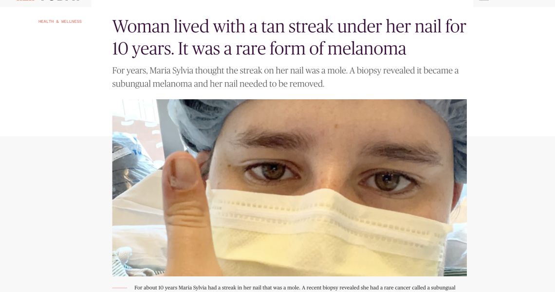 Woman lived with a tan streak under her nail for 10 years. It was a rare form of melanoma