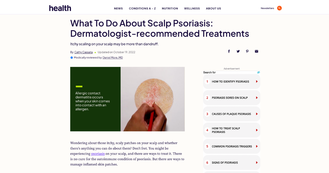 What To Do About Scalp Psoriasis: Dermatologist-recommended Treatments