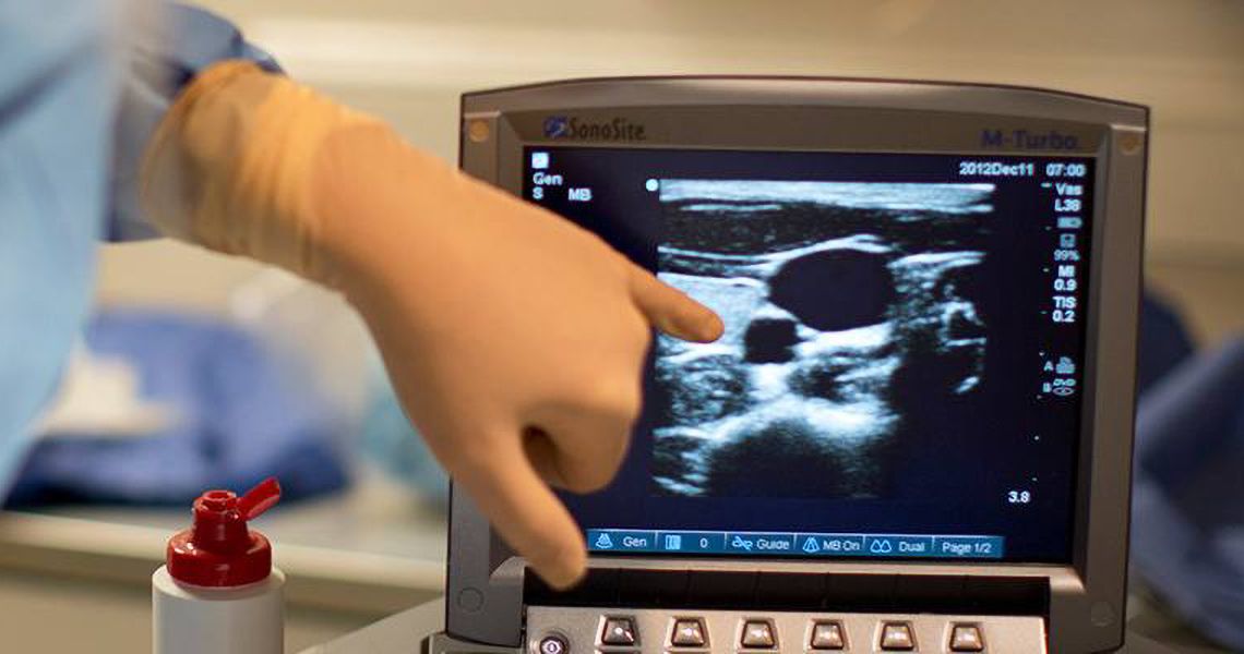 doctor's gloved hand pointing to an ultrasound monitor