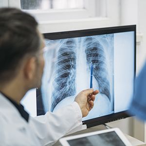 doctor pointing to a chest x-ray