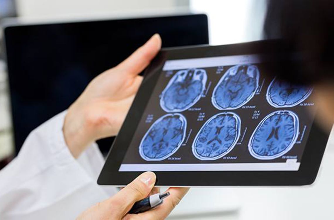 Doctor holding a tablet with brain scans