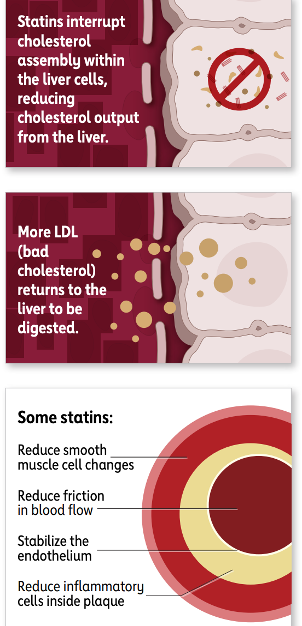 Statins diagram