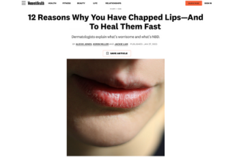 12 Reasons Why You Have Chapped Lips—And How To Heal Them Fast